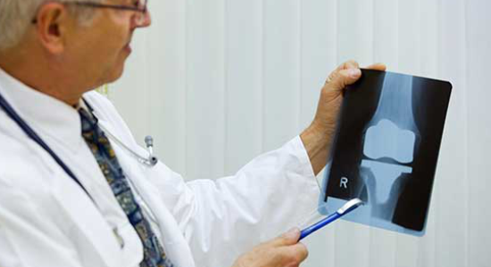 Knee Replacement Surgery, Best Doctor for Knee Replacement in Punjab, Dr J S Virk, Best Knee Replacement Surgeon in Mohali, Knee Arthritis Treatment in Punjab, Knee Pain Treatment, Knee Pain Specialist in Mohali